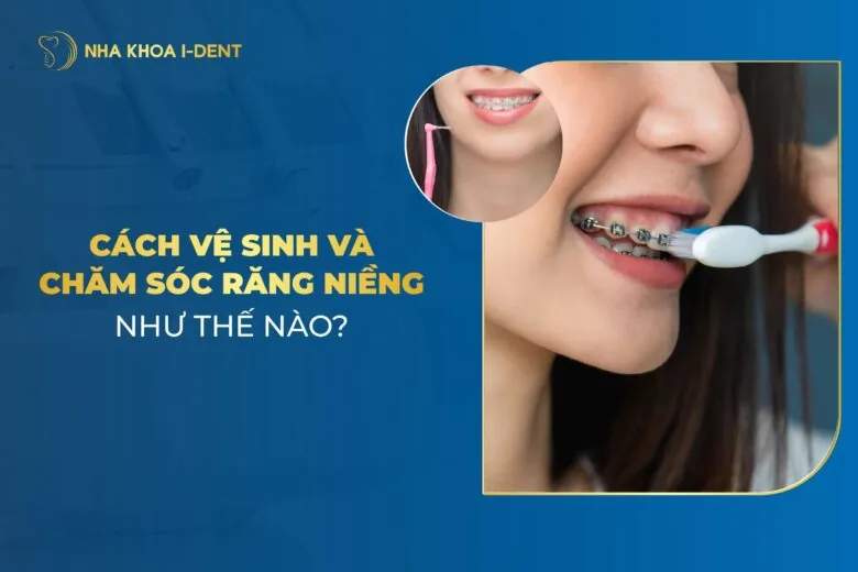 Cách Vệ Sinh Và Chăm Sóc Răng Miệng Khi Niềng Răng