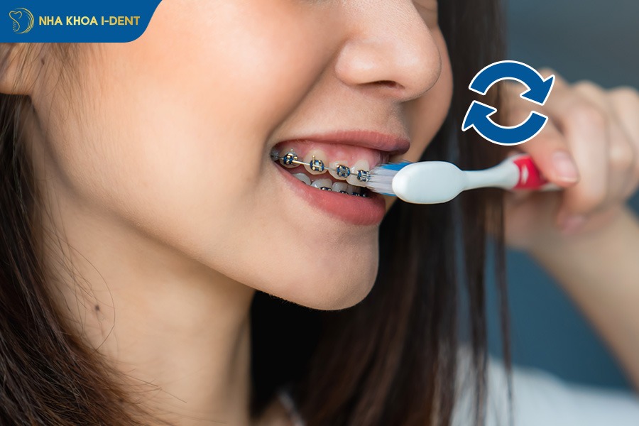 chăm sóc răng miệng khi niềng răng