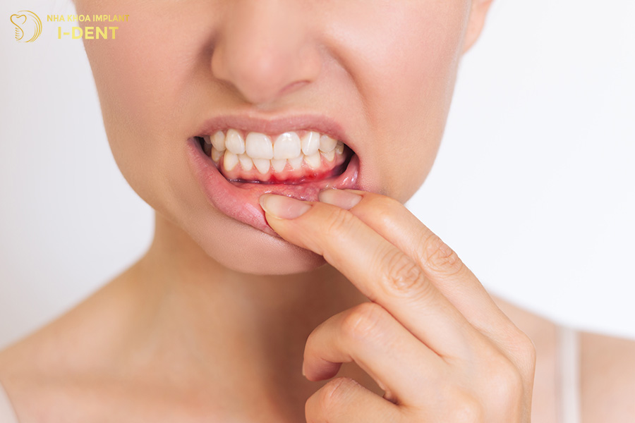 tác hại của niềng răng