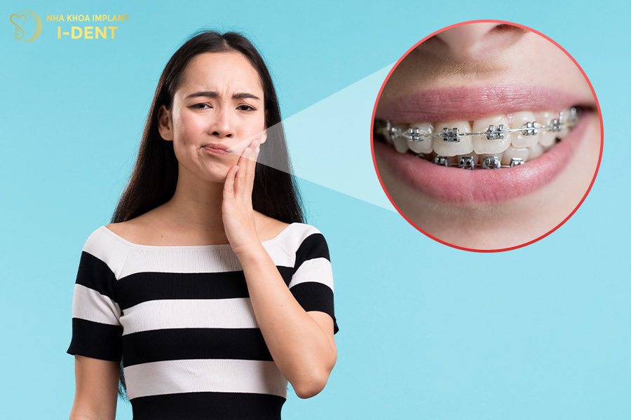 tác hại của niềng răng