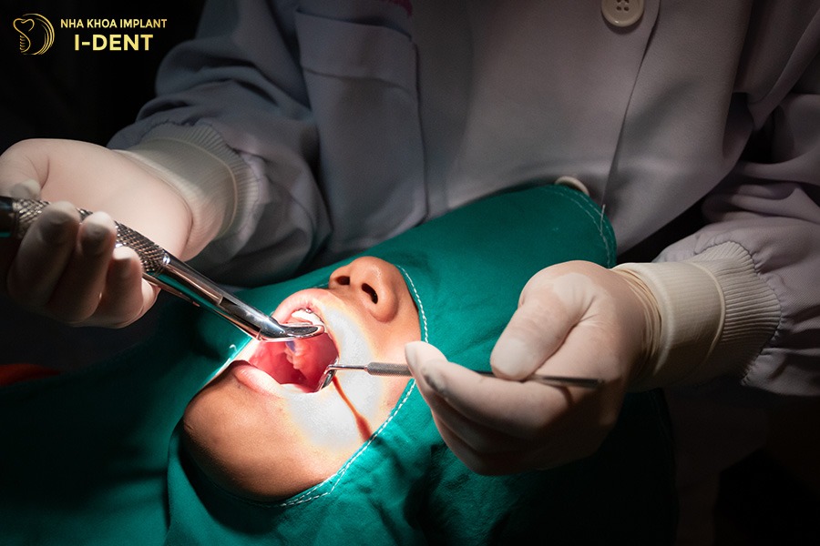 Nhổ răng giúp tạo khoảng trống để điều chỉnh răng dễ dàng hơn