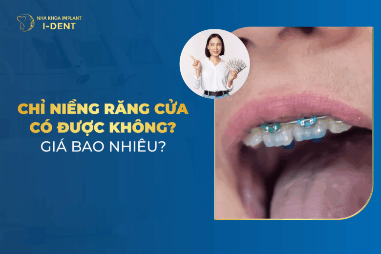 Niềng 2 Răng Cửa Giá Bao Nhiêu? Mất Bao Lâu?