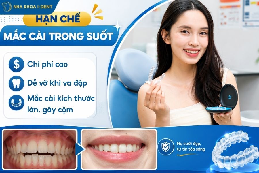 niềng răng mắc cài trong suốt là gì