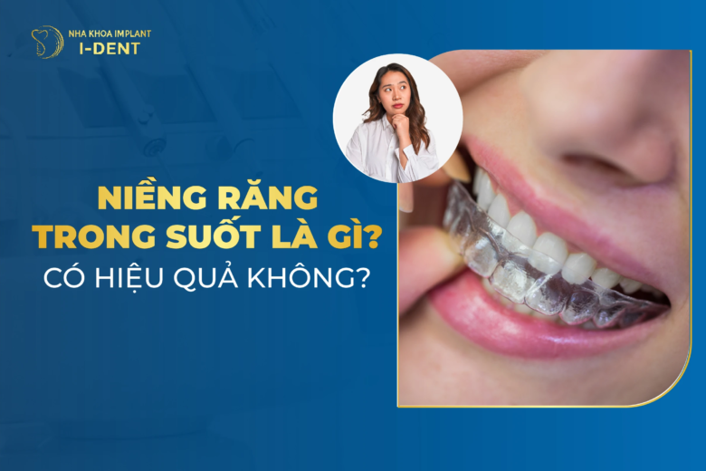 Niềng Răng Trong Suốt Là Gì? Ưu, Nhược Điểm? Mất Bao Lâu?