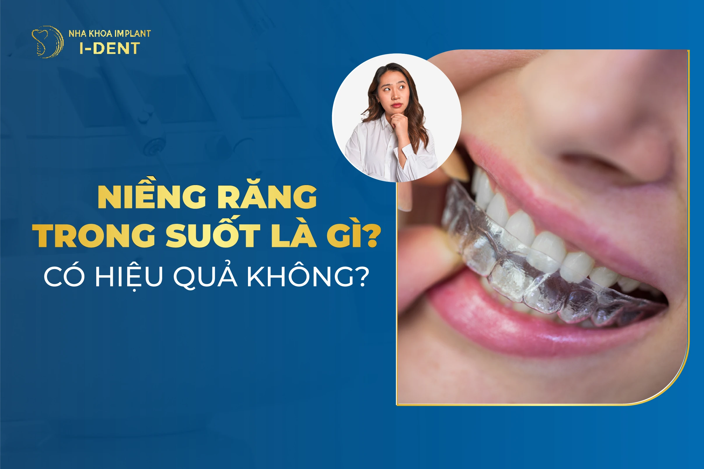 Niềng Răng Trong Suốt Là Gì? Ưu, Nhược Điểm? Mất Bao Lâu?