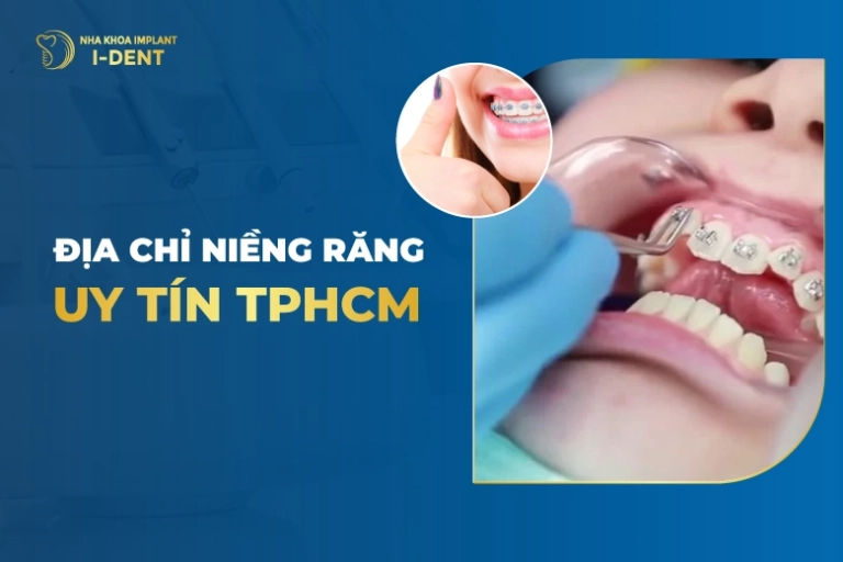 Top 10 Địa Chỉ Niềng Răng Uy Tín Tại TPHCM