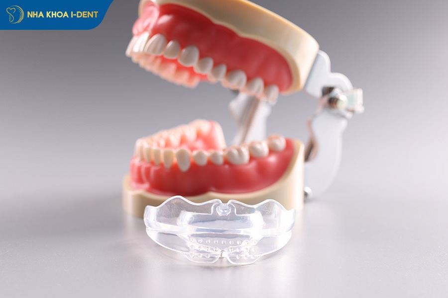 cách đeo niềng răng silicon