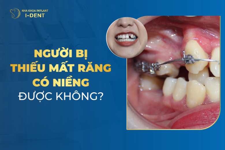 mất răng có niềng được không