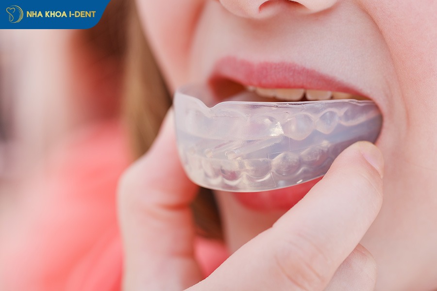 miếng niềng răng
