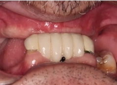 1 Đinh Văn Mạnh 09