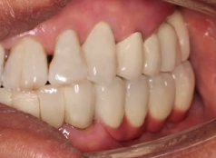 Trần Đình Hảo 30