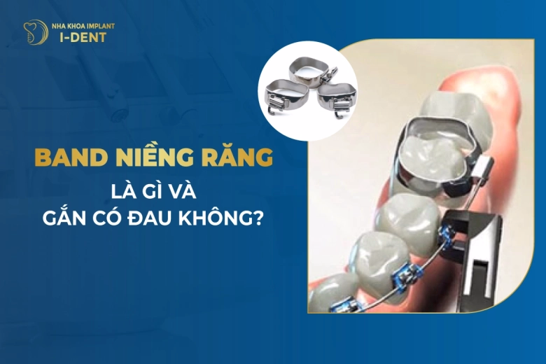 Band-Nieng-Rang-La-Gi-Va-Gan-Co-Dau-Khong