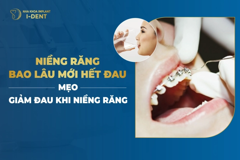 Niềng Răng Bao Lâu Mới Hết Đau? Mẹo Giảm Đau Khi Niềng Răng