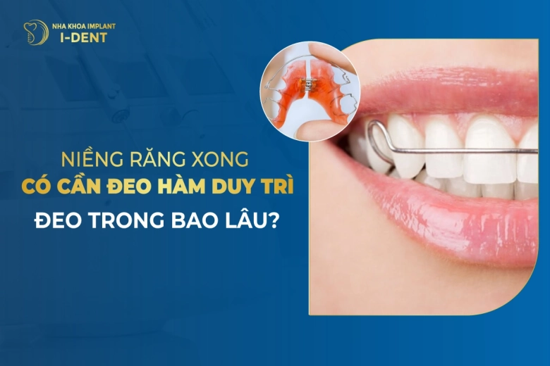 Niềng Răng Xong Có Cần Đeo Hàm Duy Trì? Đeo Trong Bao Lâu?