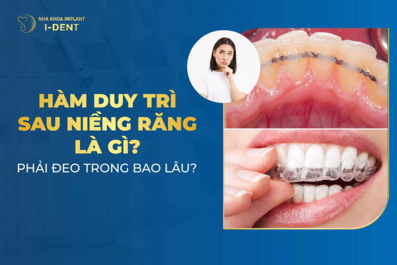 hàm duy trì sau niềng răng là gì
