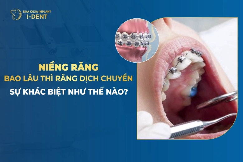 nieng-rang-bao-lau-thi-rang-dich-chuyen