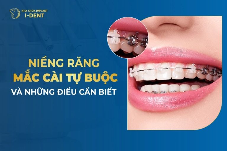 nieng-rang-mac-cai-tu-buoc-va-nhung-dieu-can-biet