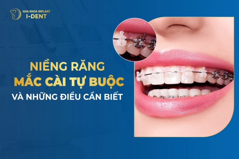 nieng-rang-mac-cai-tu-buoc-va-nhung-dieu-can-biet