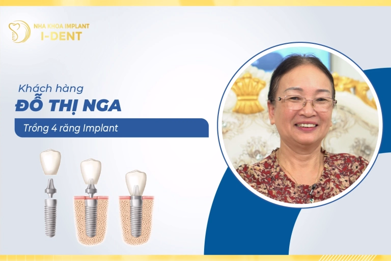 thumb-do-thi-nga