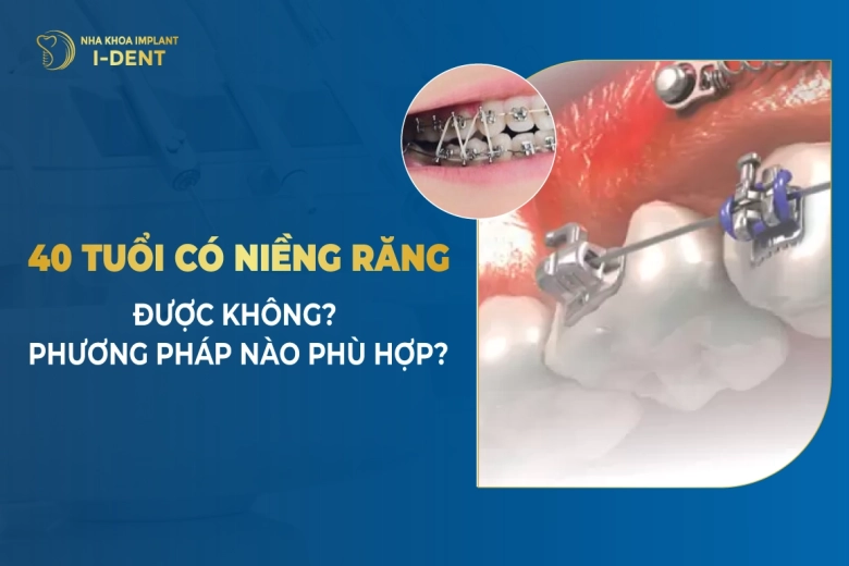 40 Tuổi Có Niềng Răng Được Không? Phương Pháp Nào Phù hợp?