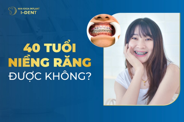 40 tuổi có niềng răng được không