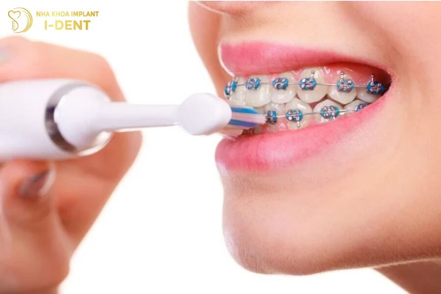 Bàn chải điện thích hợp sử dụng cho người niềng răng