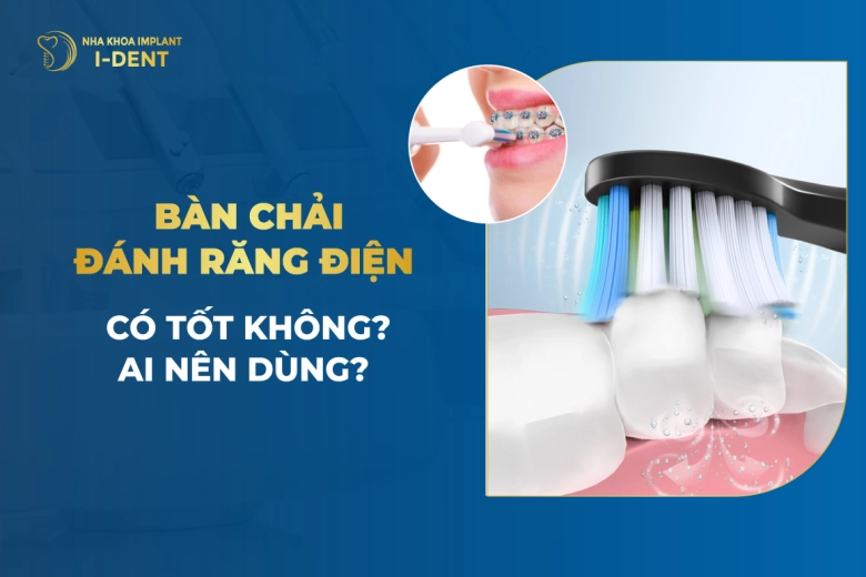 Có Nên Dùng Bàn Chải Đánh Răng Điện Không?