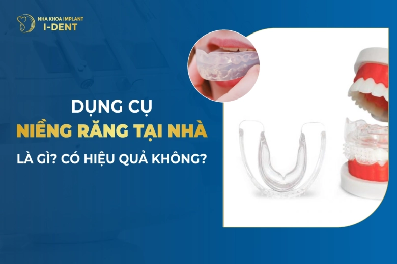 Dụng Cụ Niềng Răng Tại Nhà Là Gì? Có Hiệu Quả Không?