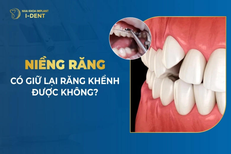 Niềng Răng Có Giữ Lại Răng Khểnh Được Không?