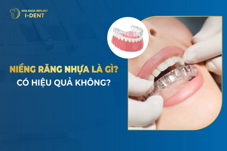 Niềng Răng Nhựa Là Gì? Có Hiệu Quả Không?