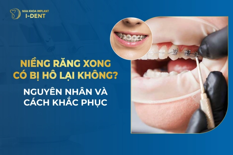 Niềng Răng Xong Có Bị Hô Lại Không? Nguyên Nhân Và Cách Khắc Phục