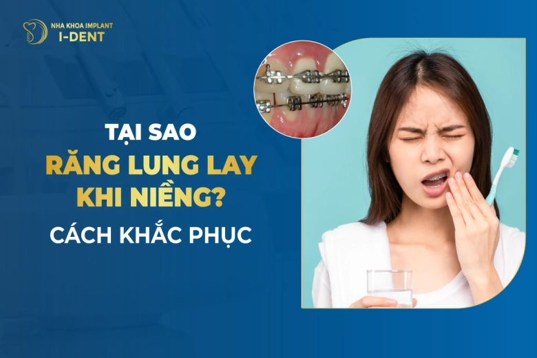 Tại Sao Răng Lung Lay Khi Niềng? Cách Khắc Phục