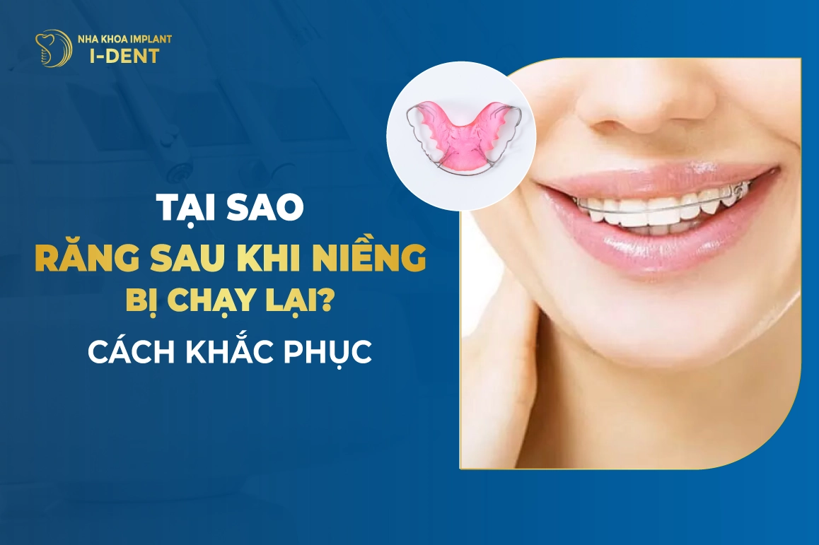 Tại Sao Răng Sau Khi Niềng Bị Chạy Lại? Cách Khắc Phục