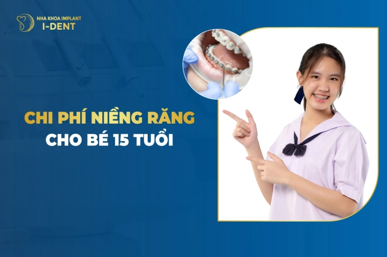 chi-phi-nieng-rang-cho-be-15-tuoi