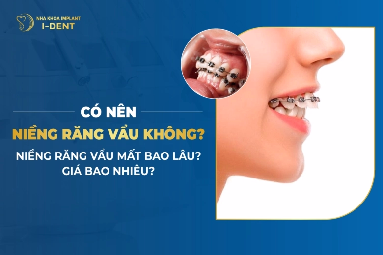 co-nen-nieng-rang-vau-khong-nieng-rang-vau-mat-bao-lau