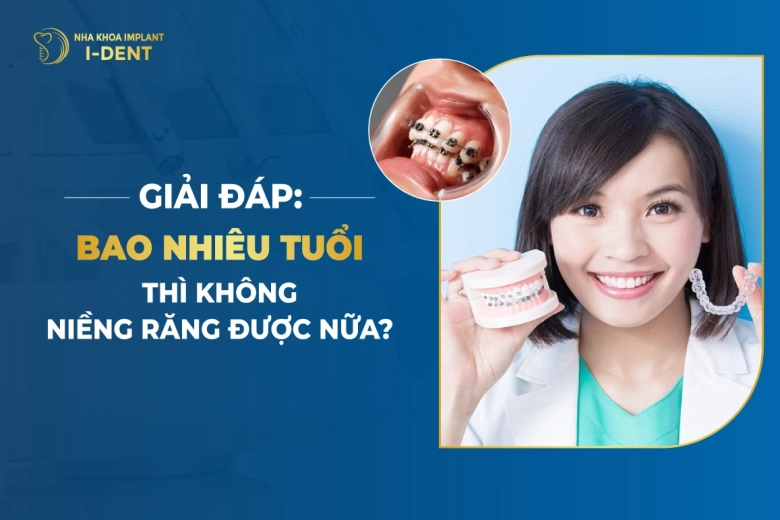 Giải Đáp: Bao Nhiêu Tuổi Thì Không Niềng Răng Được Nữa?