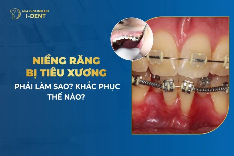 nieng-rang-bi-tieu-xuong-phai-lam-sao-khac-phuc-the-nao