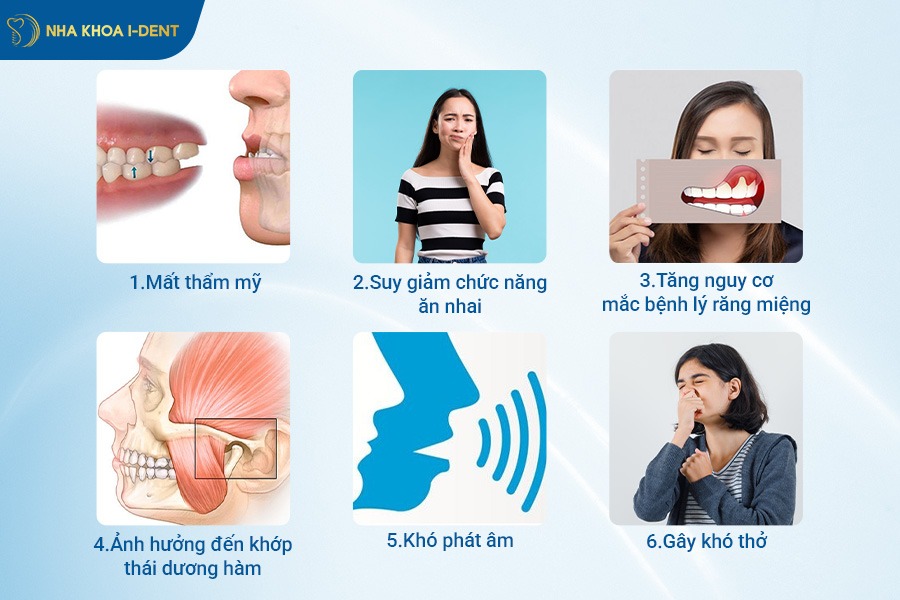 niềng răng cắn ngược