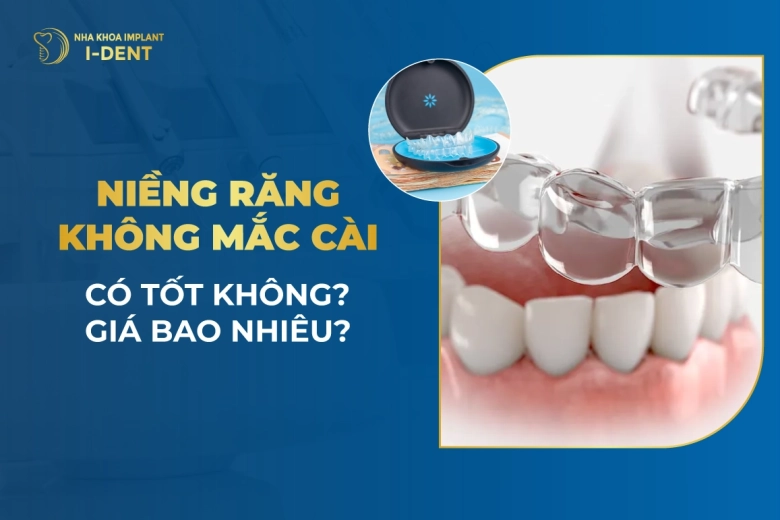 Niềng Răng Không Mắc Cài Có Tốt Không? Giá Bao Nhiêu?