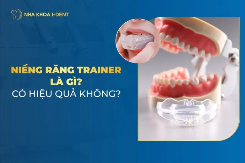 niềng răng trainer