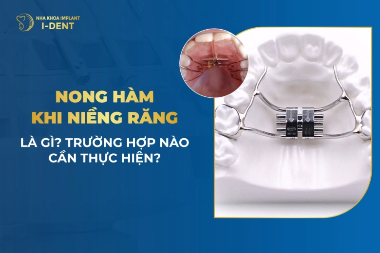 nong-ham-khi-nieng-rang-la-gi-nhung-truong-hop-nao-can-thuc-hien