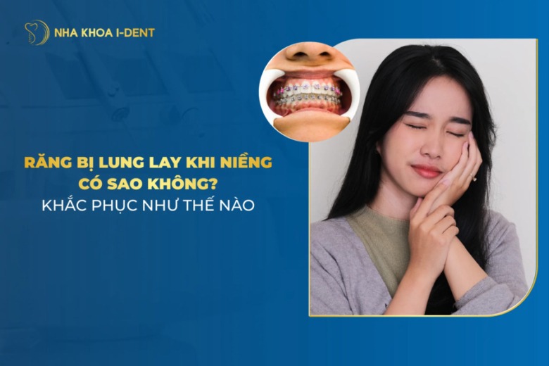 Tại Sao Răng Lung Lay Khi Niềng? Cách Khắc Phục