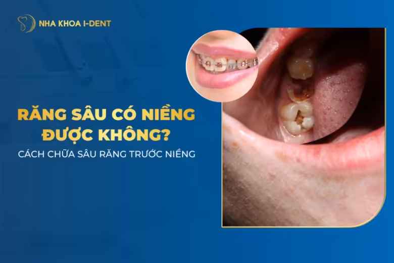răng sâu có niềng được không