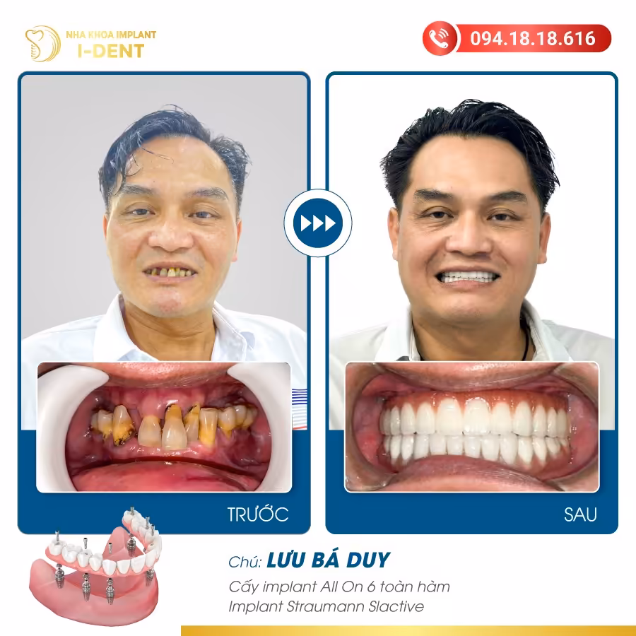 7598 Luu Ba Duy 01