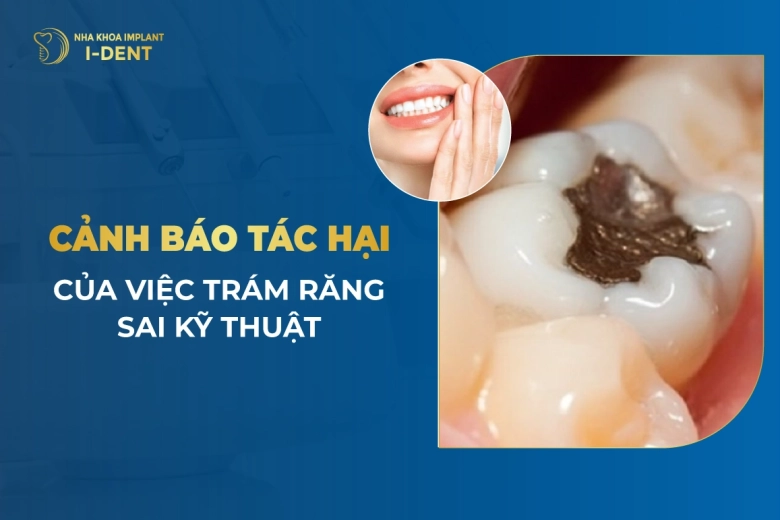 Cảnh Báo Tác Hại Của Việc Trám Răng Sai Kỹ Thuật