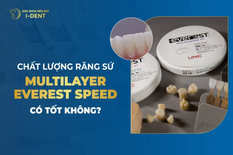 Chất Lượng Răng Sứ Multilayer EVEREST Speed Có Tốt Không?