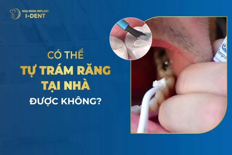 Co-The-Tu-Tram-Rang-Tai-Nha-Duoc-Khong