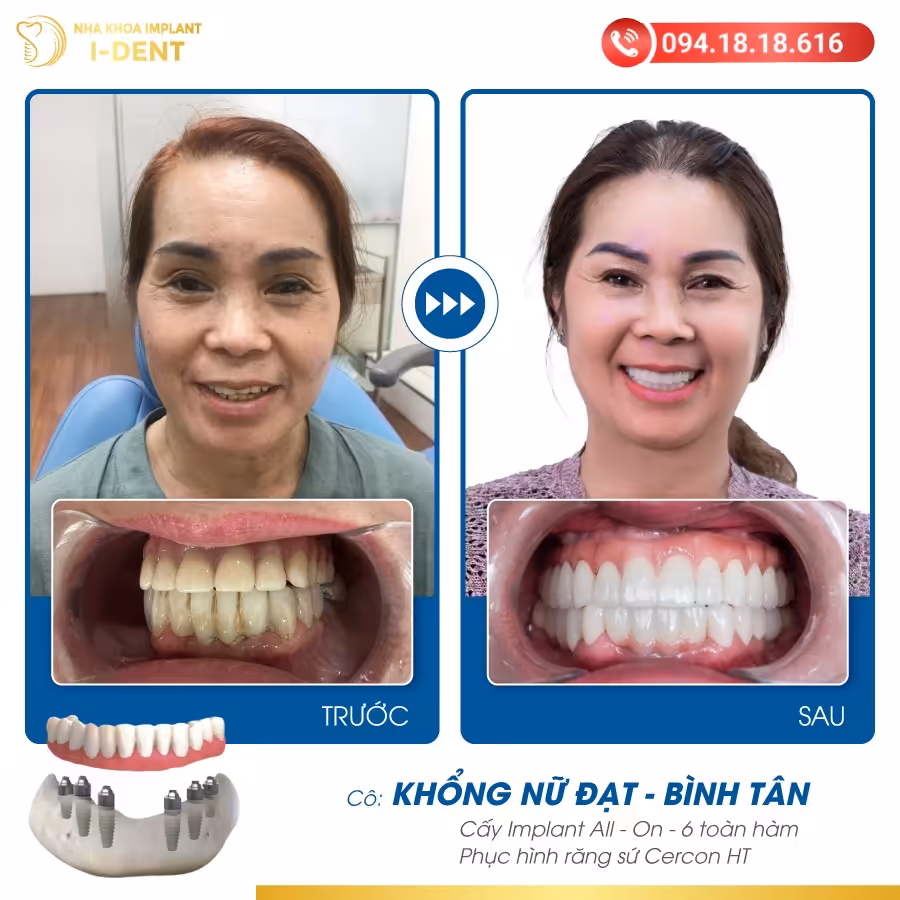 Khong Nu Dat