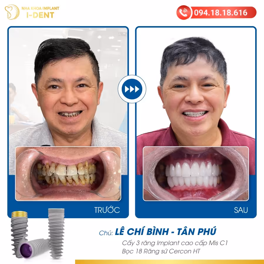 Le Chi Binh Tan Phu