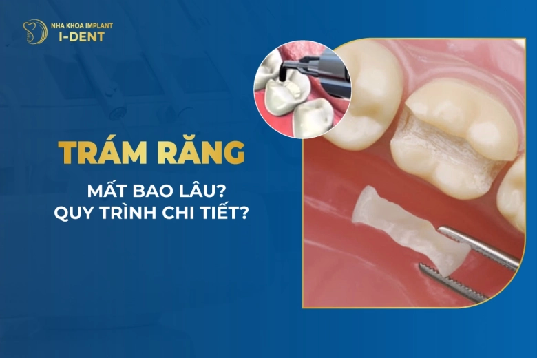 Tram-Rang-Mat-Bao-Lau-Quy-Trinh-Chi-Tiet